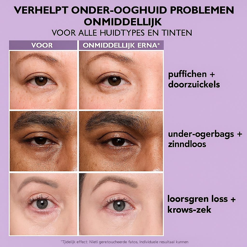 Peter Thomas Roth Instant FirmX – Directe, Tijdelijke Oogverstrakker