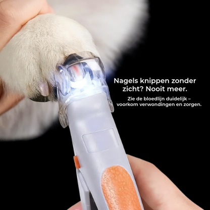 Safeclip™ Ergonomische & Veilige Nagelknipper